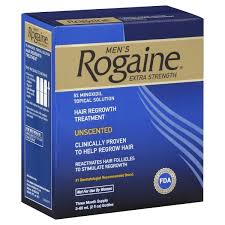 Should I use Rogaine for Telogen Effluvium?