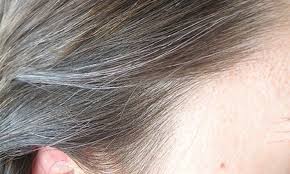 Can greying hair be reversed with copper supplementation?