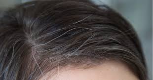 Is there anything that can reverse gray hair?