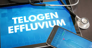 What Products Are Recommended for Telogen Effluvium?